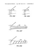 Tissue Separating Catheter Assembly and Method diagram and image