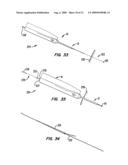 Tissue Separating Catheter Assembly and Method diagram and image