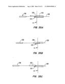 Tissue Separating Catheter Assembly and Method diagram and image