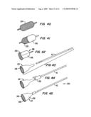 Tissue Separating Catheter Assembly and Method diagram and image