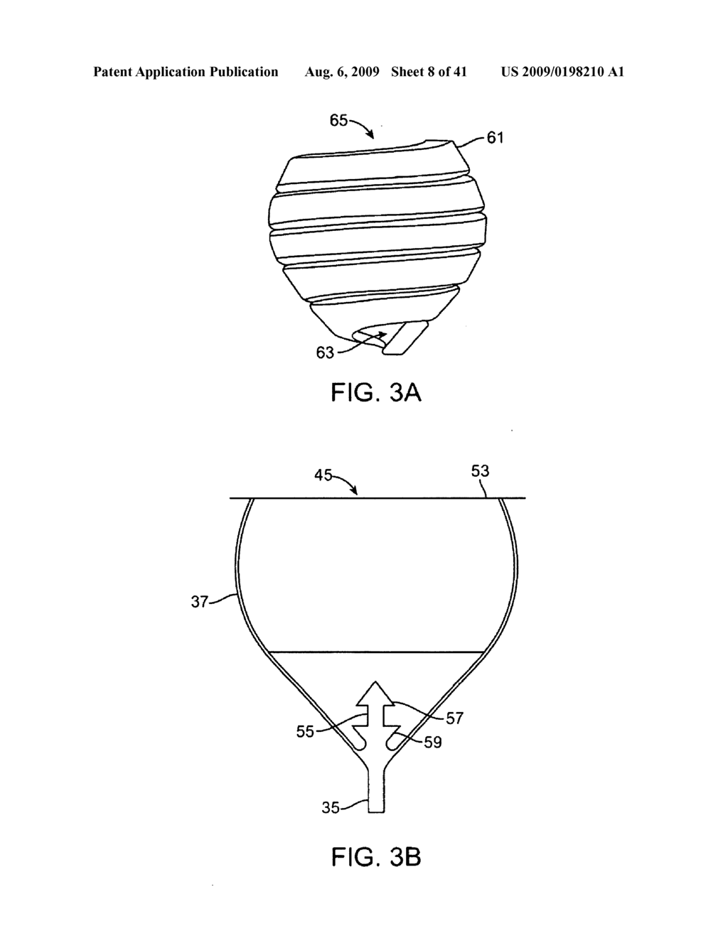 DEVICE FOR INTERMITTENTLY OBSTRUCTING A GASTRIC OPENING AND METHOD OF USE - diagram, schematic, and image 09