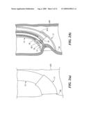 Endoscopic injection needle assembly inluding an endoscopic hood diagram and image