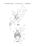 Butterfly Needle Devices and Methods Relating Thereto diagram and image