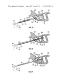 FRONTAL SINUS SPACER diagram and image