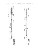 FRONTAL SINUS SPACER diagram and image