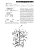 Apparatus and procedure for anterior cervical microdiskectomy diagram and image