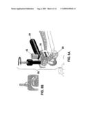 Instrument for Implanting a Wrist Prosthesis diagram and image