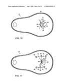 Methods and Devices for Tissue Reconfiguration diagram and image