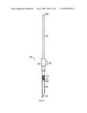 ORGANOPEXY TOOL AND ORGANOPEXY KIT diagram and image