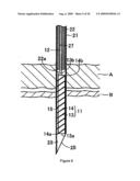 ORGANOPEXY TOOL AND ORGANOPEXY KIT diagram and image