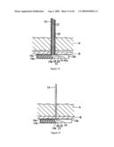 ORGANOPEXY TOOL AND ORGANOPEXY KIT diagram and image