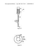 ORGANOPEXY TOOL AND ORGANOPEXY KIT diagram and image