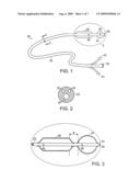 DEVICES AND METHODS FOR ABDOMINAL SURGERY diagram and image