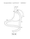 DEVICES AND METHODS FOR ABDOMINAL SURGERY diagram and image