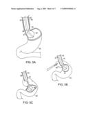 DEVICES AND METHODS FOR ABDOMINAL SURGERY diagram and image