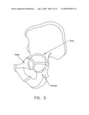 METHOD AND APPARATUS FOR RE-ATTACHING THE LABRUM OF A HIP JOINT diagram and image