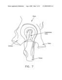 METHOD AND APPARATUS FOR RE-ATTACHING THE LABRUM OF A HIP JOINT diagram and image