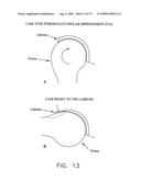 METHOD AND APPARATUS FOR RE-ATTACHING THE LABRUM OF A HIP JOINT diagram and image