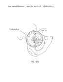 METHOD AND APPARATUS FOR RE-ATTACHING THE LABRUM OF A HIP JOINT diagram and image