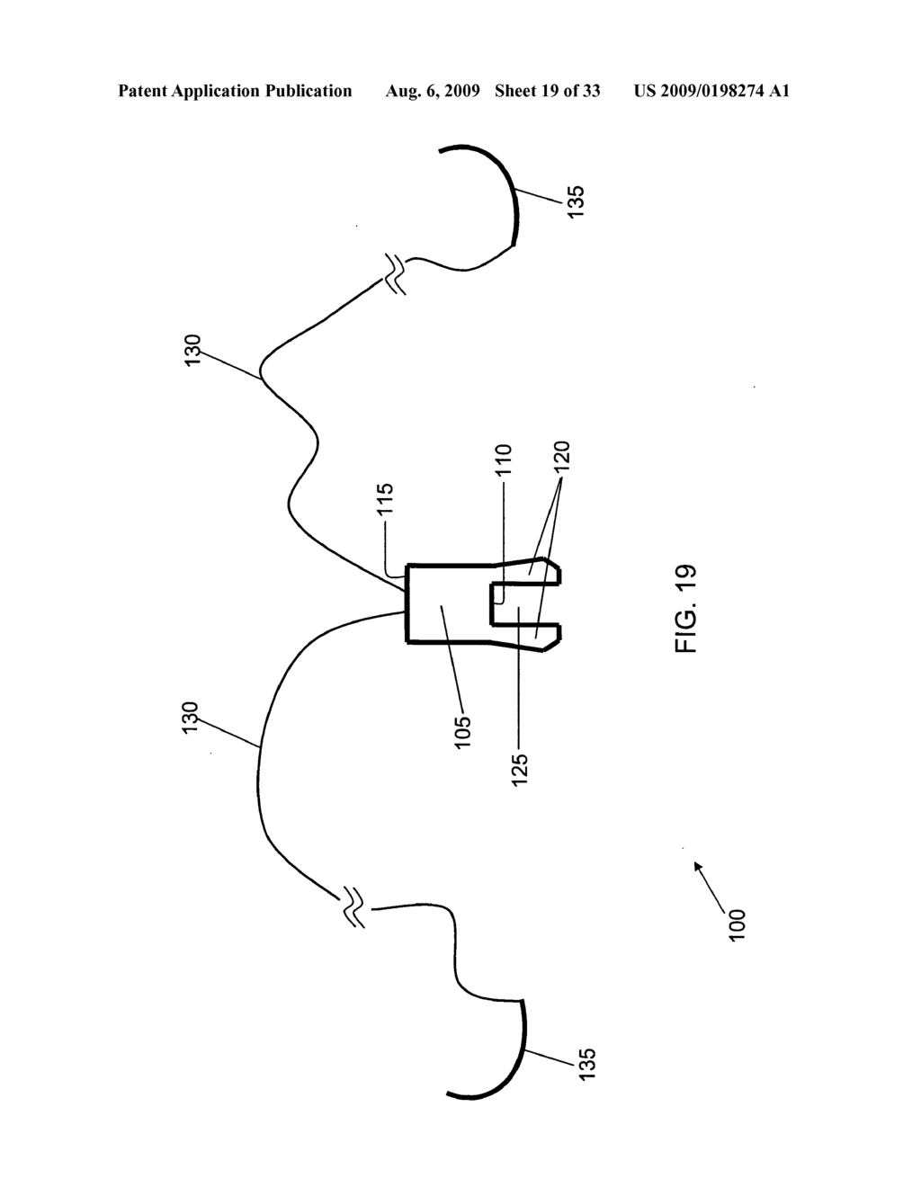 METHOD AND APPARATUS FOR RE-ATTACHING THE LABRUM OF A HIP JOINT - diagram, schematic, and image 20