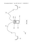 METHOD AND APPARATUS FOR RE-ATTACHING THE LABRUM OF A HIP JOINT diagram and image