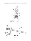 SPINAL IMPLANT AND METHOD FOR RESTRICTING SPINAL FLEXION diagram and image