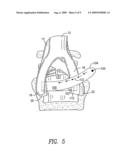 METHODS AND APPARATUS FOR VASCULAR PROTECTION IN SPINAL SURGERY diagram and image