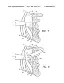 METHODS AND APPARATUS FOR VASCULAR PROTECTION IN SPINAL SURGERY diagram and image