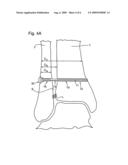 BONE FIXATION DEVICE AND METHOD OF USE THEREOF diagram and image