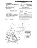DIRECT INDUCTIVE/ACOUSTIC CONVERTER FOR IMPLANTABLE MEDICAL DEVICE diagram and image