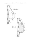 METHOD FOR TEXTURING THE SURFACE OF A SYNTHETIC IMPLANT diagram and image