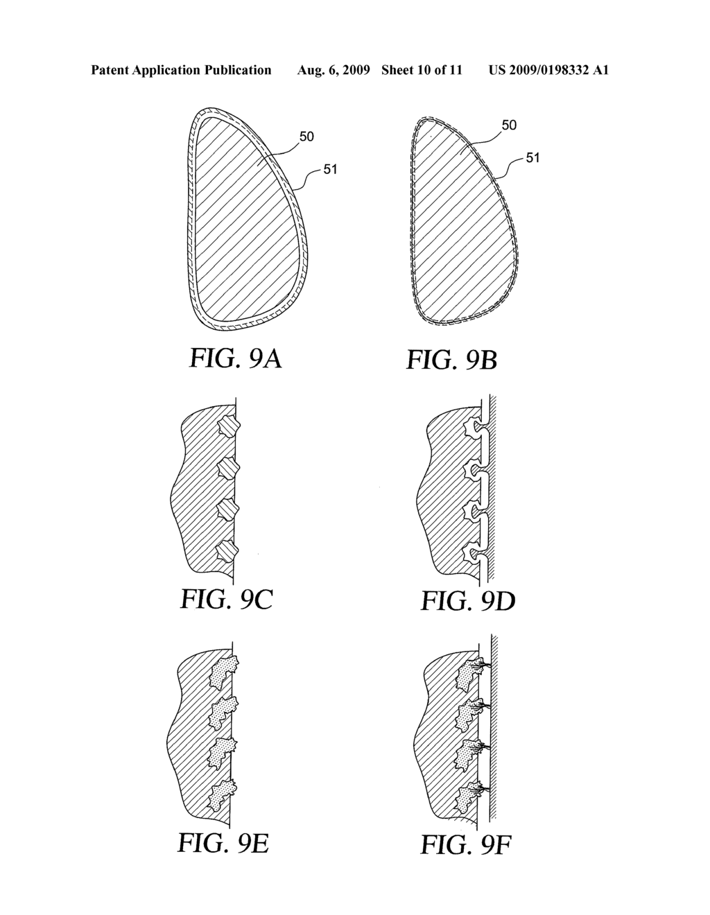 METHOD FOR TEXTURING THE SURFACE OF A SYNTHETIC IMPLANT - diagram, schematic, and image 11