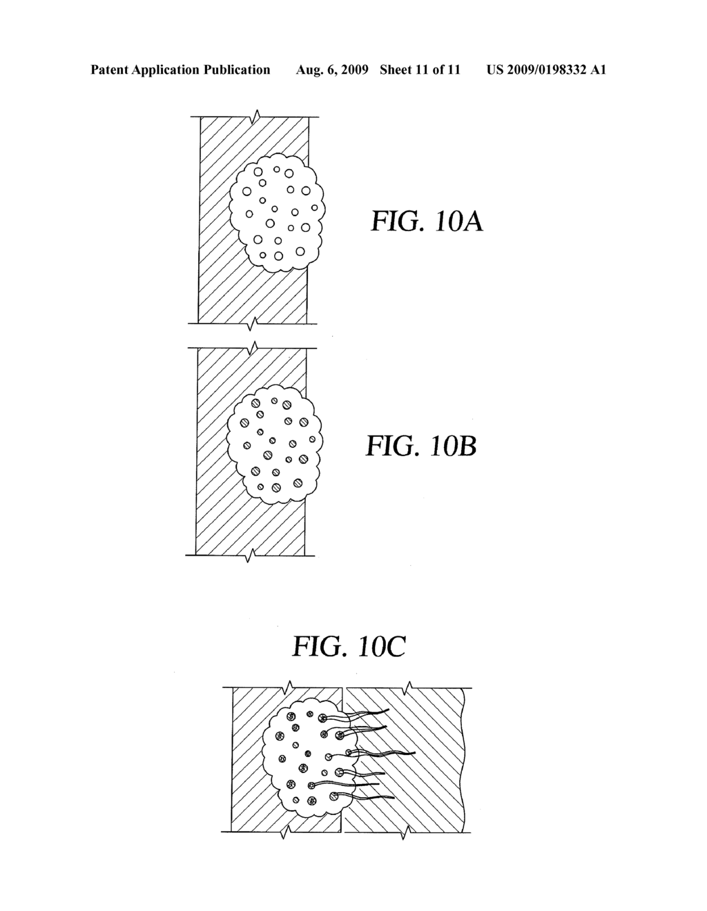 METHOD FOR TEXTURING THE SURFACE OF A SYNTHETIC IMPLANT - diagram, schematic, and image 12