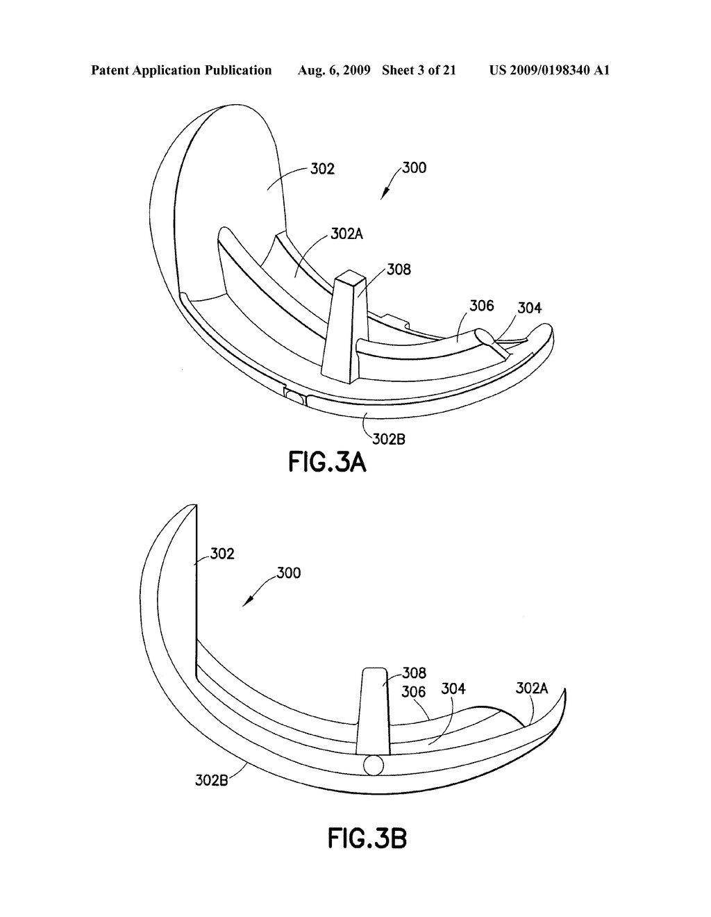 FEMORAL COMPONENT OF KNEE PROSTHESIS, THE FEMORAL COMPONENT HAVING ANTERIOR/POSTERIOR CLAW(S) FOR DIGGING INTO BONE AND/OR A RAISED RIB WITH A BULBOUS TERMINUS - diagram, schematic, and image 04