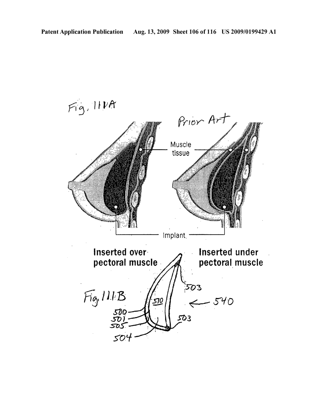 DEVICES WITH INTERNAL FLEXIBILITY SIPES, INCLUDING SIPED CHAMBERS FOR FOOTWEAR - diagram, schematic, and image 107