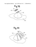 MEANS FOR PENETRATING A PORTION PACKAGING CONTAINING AN EXTRACTION PRODUCT, DEVICE FOR EXTRACTING THE EXTRACTION PRODUCT CONTAINED IN THE PORTION PACKAGING, AND METHOD FOR PRODUCING THE MEANS diagram and image