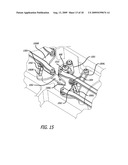 STEERING SYSTEM WITH PARALLELOGRAM LINKAGE FOR HEAVY MOBILE MEDICAL EQUIPMENT diagram and image