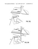 THREAD CONTROL IN MULTI-NEEDLE CHAIN STITCH QUILTING diagram and image