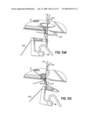 THREAD CONTROL IN MULTI-NEEDLE CHAIN STITCH QUILTING diagram and image