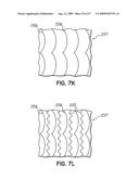 THREAD CONTROL IN MULTI-NEEDLE CHAIN STITCH QUILTING diagram and image