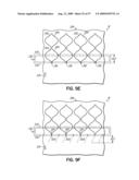 THREAD CONTROL IN MULTI-NEEDLE CHAIN STITCH QUILTING diagram and image