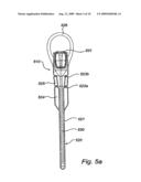 CATHETER ASSEMBLY diagram and image