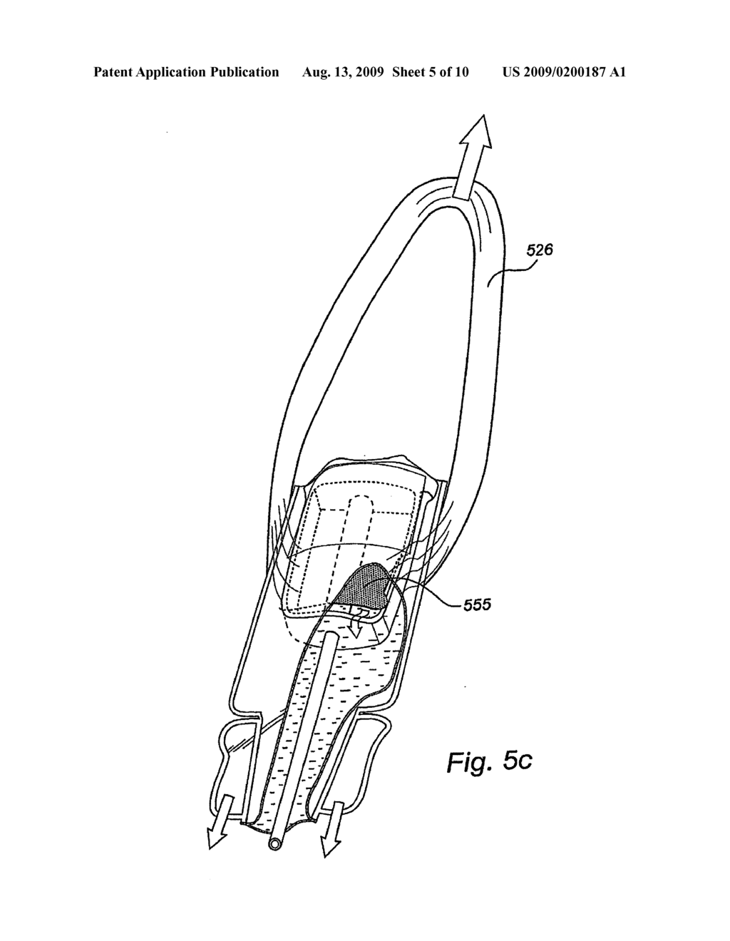 CATHETER ASSEMBLY - diagram, schematic, and image 06