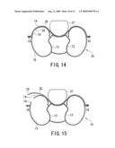 AIRBAG DEVICE diagram and image