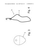 Busterbite diagram and image