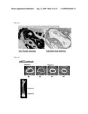 MODEL ANIMAL OF DENDRITIC CELL IMMUNORECEPTOR GENE KNOCKOUT DISEASE diagram and image