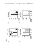 Detection of inflammatory disease and composition for preventing or treatment of inflammatory disease diagram and image