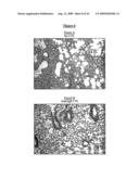 EX-VIVO PRIMING FOR GENERATING CYTOTOXIC T LYMPHOCYTES SPECIFIC FOR NON-TUMOR ANTIGENS TO TREAT AUTOIMMUNE AND ALLERGIC DISEASE diagram and image