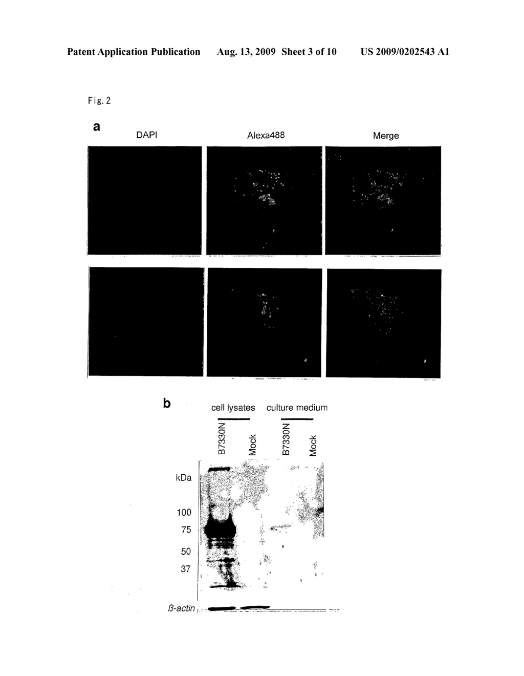 GENE AND POLYPEPTIDE RELATING TO BREAST CANCER - diagram, schematic, and image 04