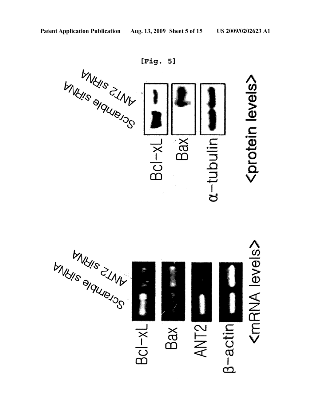 GENE THERAPY FOR CANCER USING SMALL INTERFERING RNA SPECIFIC TO ANT2 AND A METHOD TO OVERCOME TOLERANCE TO ANTITUMOR AGENT - diagram, schematic, and image 06